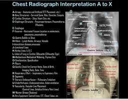 Image result for Chest XRay Interpretation