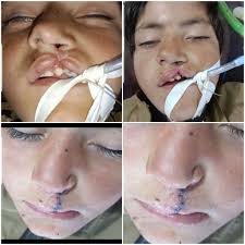 Surgeon Dr Abdul Rub Achakzai