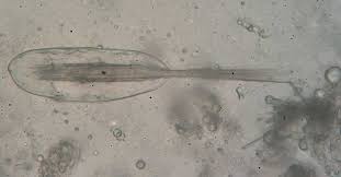 We did not find results for: Idioblast Wikipedia