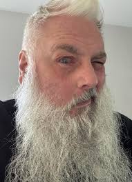 Helichrysum for when you get a stick in your eye