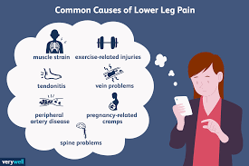 Not always, but this is a really good guess and the best you will get without getting medical devices involved (ultrasound, mri, scans, etc.). Lower Leg Pain Symptoms Causes And Treatment