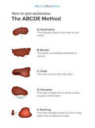 It may look like a mole that is totally different from the other moles on it is necessary to know that most people who have skin cancer feel perfectly fine! Skin Cancer Symptoms Types And Warning Signs