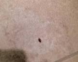 Bed bug - Picture of Embassy Suites by Hilton Philadelphia Airport ...
