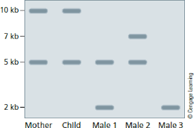 Dna profiling, dna testing, dna analysis, genetic profile, dna identification, genetic fingerprinting, and genetic analysis are some of the popular names used for dna fingerprinting. Dna Profiles As Tools For Identification A Pcr Based Paternity Test Is Conducted Using Strs That Consistently Produce A Unique Dna Fragment Pattern From A Single Chromosome Examining The Results Of The Following