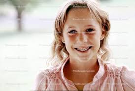 Girl, Smiles, Happy, Face, Braces, Teeth, 1960s, Child, Photo