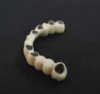 Pfm Tooth Bridge Porcelain Fused to Metal (Cobalt chrome alloy) Good  Biological Compatibility, High Strength, Economical, Cost-Effective.
