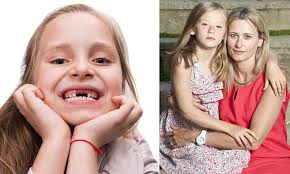 Check spelling or type a new query. Middle Class Parents Who Ve Ruined Their Children S Teeth By Giving Them Healthy Treats Daily Mail Online