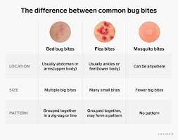 I have like 200 flea bites on my legs. How To Identify And Treat Bed Bug Bites Business Insider India