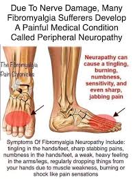 Pin By Katrina Betts On Fibromyalgia Fibromyalgia Causes Peripheral Neuropathy Fibromyalgia