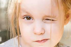 Pediatric Astigmatism Causes Signs And Prognosis