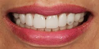 Harmonisierung Der Gesichtszuge Dr Rudiger Hansen