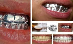 Memang apabila anda menggunakan cara putihkan gigi guna garam ini maka anda bisa. Cara Cepat Memutihkan Gigi Menggunakan Aluminium Foil