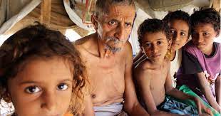 Größte humanitäre krise der welt jemen steht hungersnot bevor im jemen leiden schon jetzt fast 50.000 menschen unter hungersnotähnlichen bedingungen. Jemen Krieg Und Hunger Weltspiegel Ard Das Erste