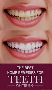 How to whiten teeth reddit. Pin On Teeth Whitening Advertisement