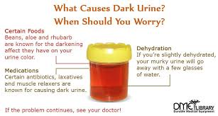 Paying Attention To Your Urine Color Is A Good Way To Stay On Top Of Your Health Urinal Muscle Relaxer Cloudy Urine