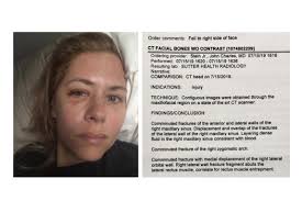 Fundraiser for Heidi Grunenwald by Scott Keneally : Heidi G. Needs Surgery!