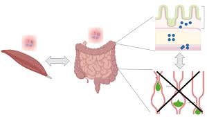 Image result for Polymyositis