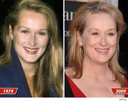 Meryl Streep 30 Years Old And 60 How To Prevent Aging Meryl Streep Plastic Surgery Hair Implants