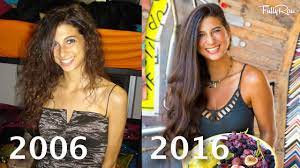 Hair Falling Out On A Raw Vegan Diet My Hair Transformation Http Veganvideorecipes Com Hair Falling Out On A Raw V Raw Vegan Diet Fall Hair Vegan Diet