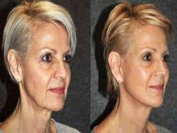 Brandon Verkler's Instagram, Twitter & Facebook