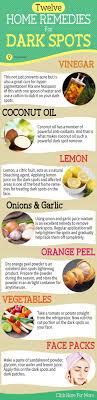 How To Remove Dark Spots On Face Fast 6 Home Remedies Dark Spots On Face Spots On Face Acne Dark Spots