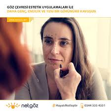 Ameliyatsiz Goz Cevresi Uygulamalari Ile Daha Canli Daha Genc Bir Gorunume Kavusabilrsiniz Zamanin Goz Cevrenizde Olusturdugu Izleri S Estetik Gozler Gencler