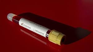 Turkey Provides Online Access To Covid 19 Test Results