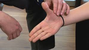 Related online courses on physioplus. Ucl Repair Restores Use Of Teen Athlete S Thumb Wlos