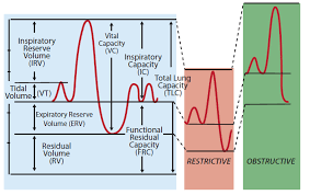 Image result for Vital Capacity