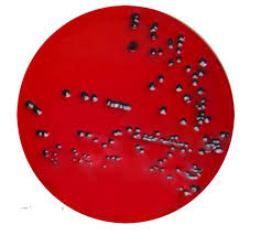 In xylose lysine dextrose agar (xld) medium, the colonies of salmonella appears red due to the fermentation of xylose which lowers the ph of medium and the presence of phenol red (indicator) imparts a pink or red color to the salmonella typhi colonies with a black center which is due to the production of h2s (hydrogen sulfide). Xld Agar Xylose Lysine Desoxycholate Agar Iso 6579
