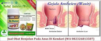 Pin Di Obat Benjolan Pada Anus