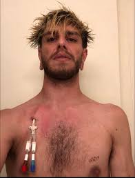 Any had transplant at vcu Richmond