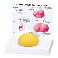 Anatomical Breast Cancer Model