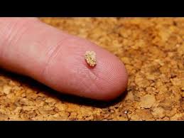 Pin On Home Remedies