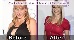 Let's admit that jodie sweetin's plastic surgery has definitely boosted her body shape and now she reflects the woman's beauty standard. Jodie Sweetin S Boob Job Before After Photos Of Her Plastic Surgery