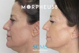 Jay Applebaum, MD, 1506 E Chapman Ave, Orange, CA 92866, US