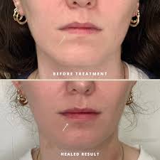 Danielle P. RN, BSN (@danielle.injects) • Instagram photos and videos