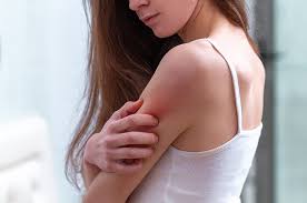 Scabies is a common and persistent skin condition that causes intense itching. 4 Gejala Scabies Yang Perlu Diwaspadai