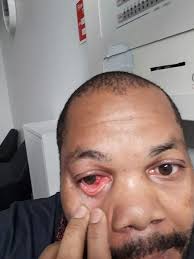 Student left with fracture to skull after 'racist' attack