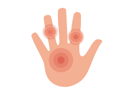You may also have tingling, numbness, pain and dryness. Top 11 Causes Of Hand Swelling Buoy