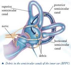Image result for Canalith Repositioning Procedure