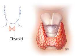 Hashimoto's disease - Symptoms & causes - Mayo Clinic