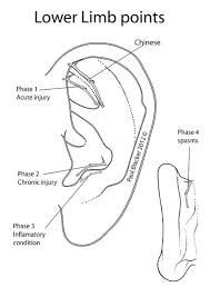 Pin On Auricular Acupuncture