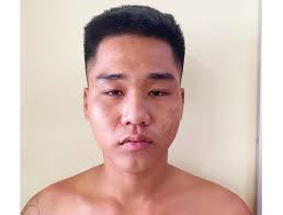 Bắt nghi phạm thứ 5 trong vụ 1 phụ nữ thuê giang hồ chém chủ nợ