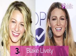 Vidéo : J.Lo, Jenifer, Blake Lively ... Elles ont eu recours à la  rhinoplastie !