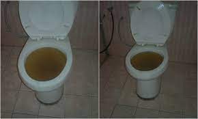 Hahaha.apa punya topic la aku hendak cerita aku dekat rumah tandas jenis duduk, tapi bila pergi tandas awam memang aku tidak suka. Normal Plumbing Tandas Tersumbat