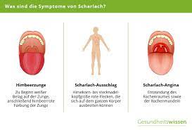 Bis zu drei wochen ansteckend. Scharlach Symptome Verlauf Schutzmassnahmen