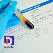 Image result for Herpes Simplex Virus Testing