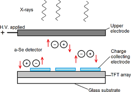 Resar said, adding it is image quality that clearly sets flat panel. X Ray Imaging Book Chapter Iopscience