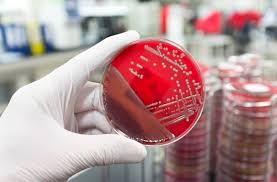 We did not find results for: Staph Infections What You Should Know Penn Medicine